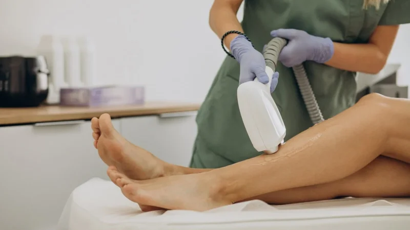 Depilacja laserowa bikini brazylijskie: wszystko, co musisz wiedzieć