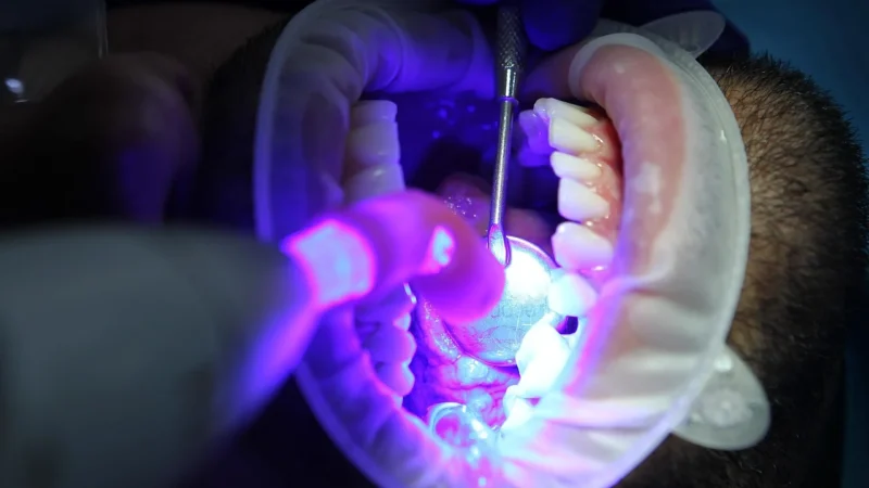 Gdzie w Corby znaleźć dentystę specjalizującego się w wybielaniu zębów?