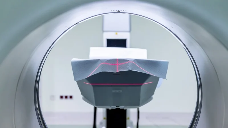 Nowoczesne metody badań obrazowych: rezonans magnetyczny (MRI)