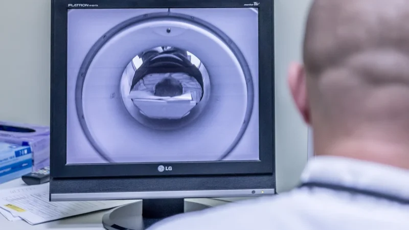 Zastosowanie rezonansu magnetycznego w diagnostyce medycznej